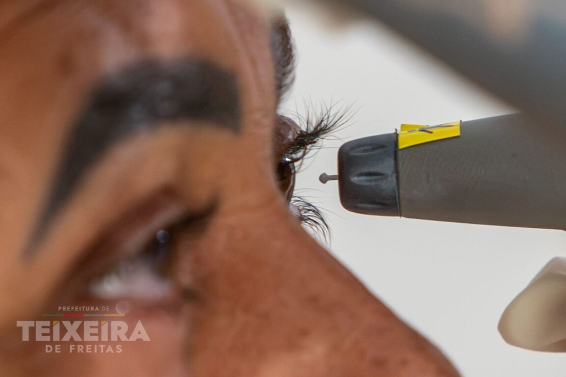 Mutirão do Glaucoma atende 667 pacientes em Teixeira de Freitas 19 WhatsApp Image 2026 08 08 at 11.18.50