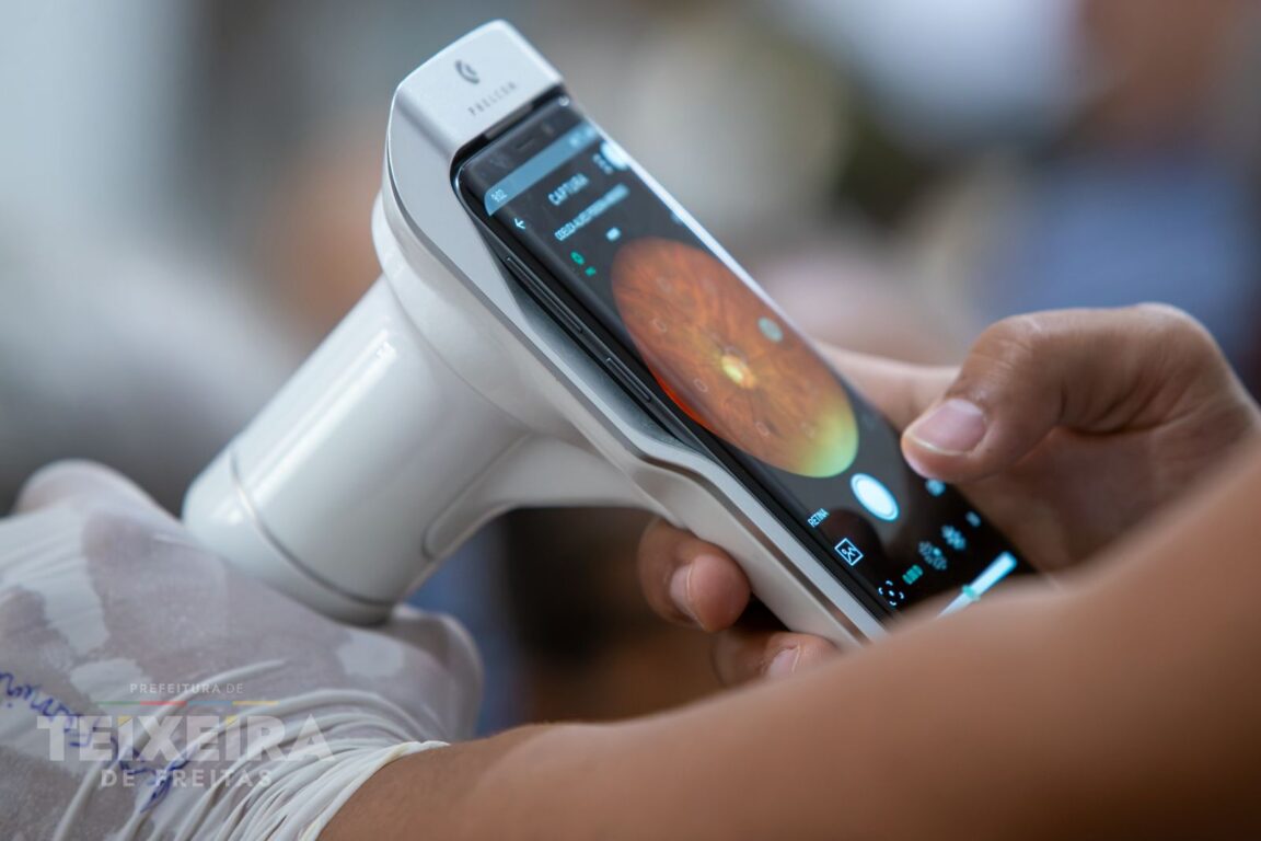 Mutirão do Glaucoma atende 667 pacientes em Teixeira de Freitas 20 WhatsApp Image 2026 08 08 at 11.18.51 2