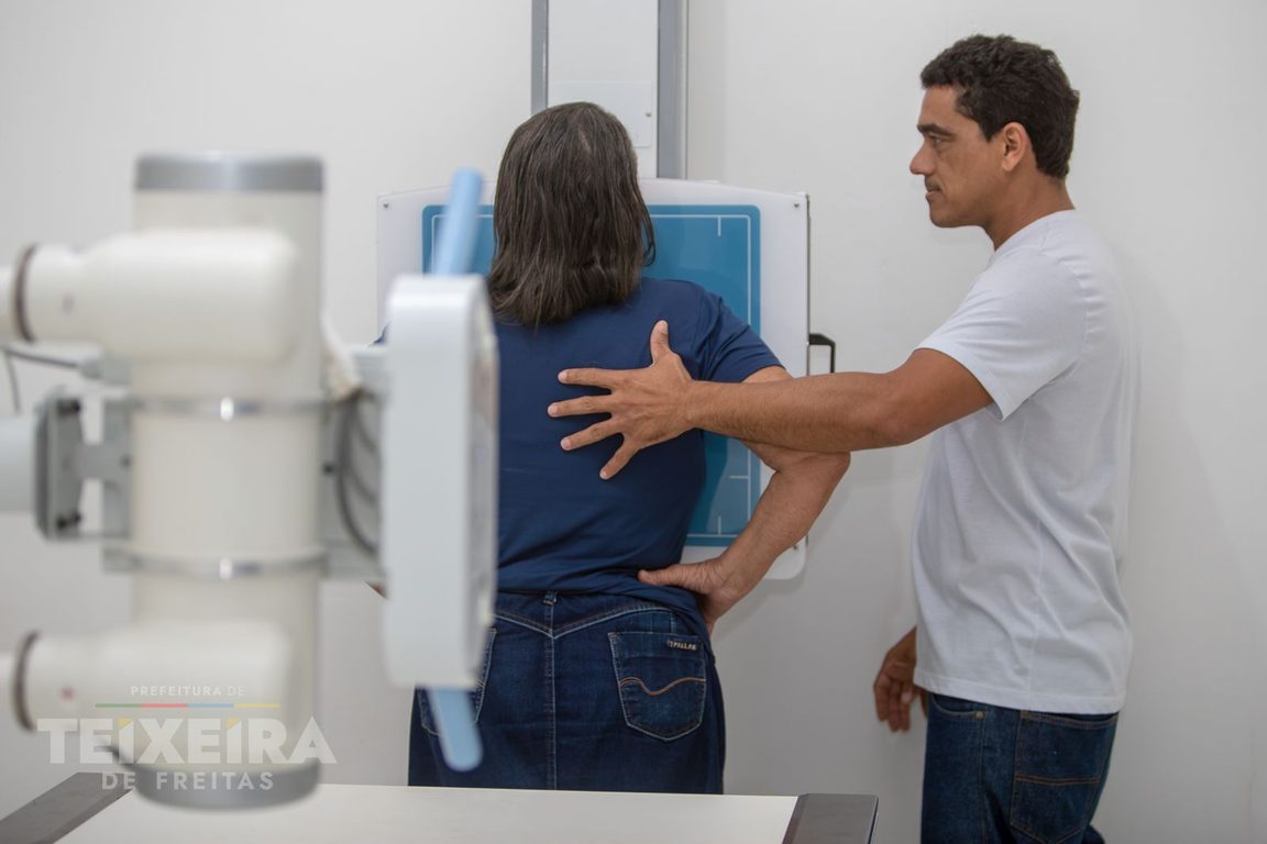 Mutirão de raio-X no CTO